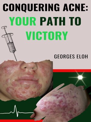 cover image of Conquering Acne